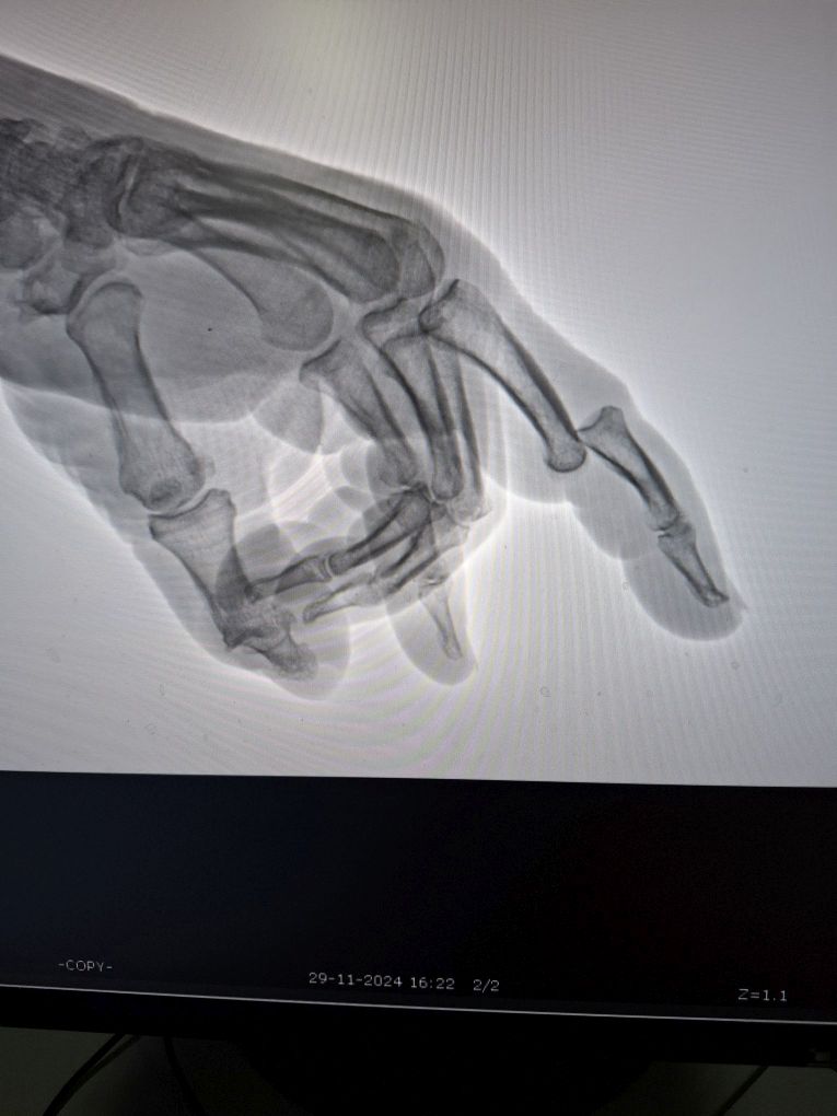 5 Finger